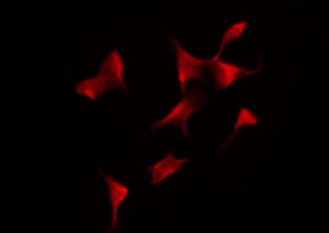 PRKAB1 / AMPK Beta 1 Antibody