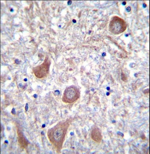 PTCHD1 Antibody (aa611-639)