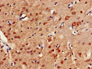 ERCC4 / XPF Antibody