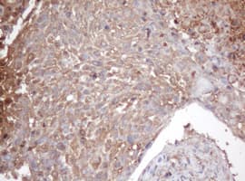 PSMA2 Antibody (clone OTI3B3)