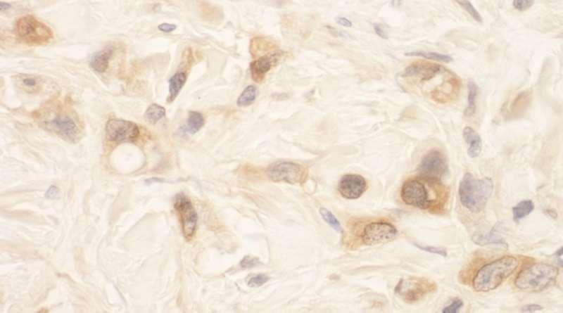 Polyclonal Rabbit anti-Human STK39 / SPAK Antibody (aa425-450, IHC)