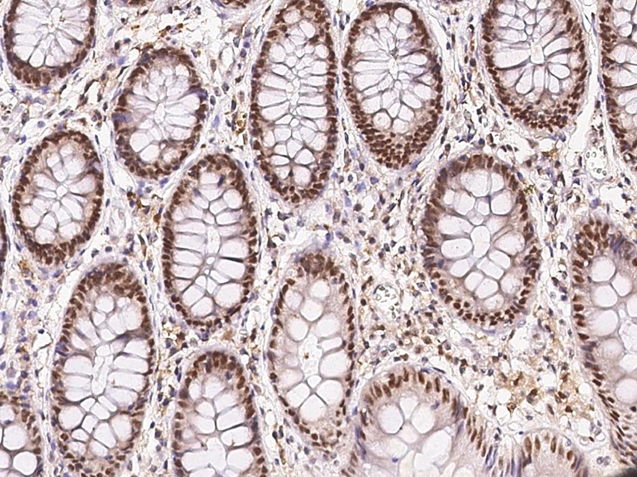 ECD Antibody (Preservative Free)