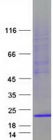 Human TRAPPC2 / SEDL Protein (Recombinant Myc-DDK (Flag))