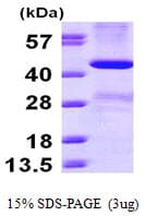 Human LIF Protein (Recombinant His)