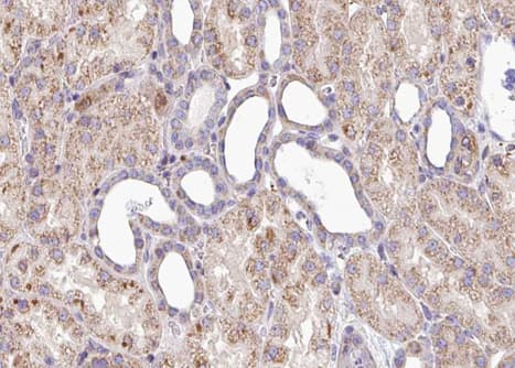 Polyclonal Rabbit anti-Human SOX9 Antibody (phospho-Ser181, IHC, IF, WB)