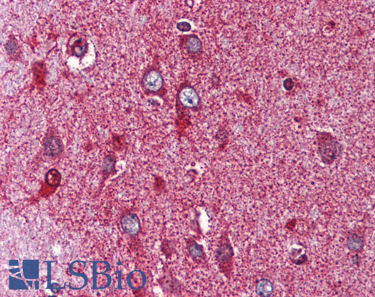 PathPlus™ Nor-1 / NR4A3 Antibody (Internal)