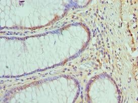 HSPH1 / HSP105 Antibody (aa659-858)