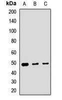 GCD / GCDH Antibody