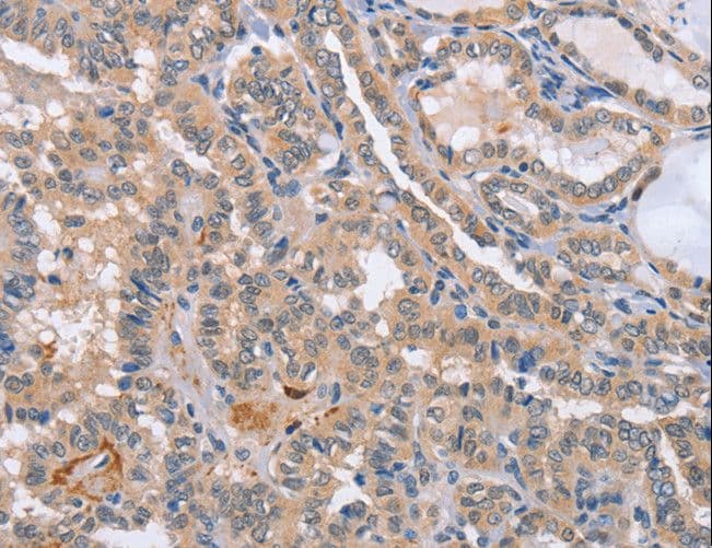 CD36 Antibody