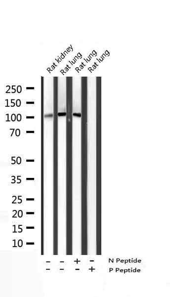Polyclonal Rabbit anti-Human STAT2 Antibody (phospho-Tyr690, IHC, IF, WB)