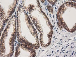 CTNNB1 / Beta Catenin Antibody (clone OTI1E10, Carrier-free)