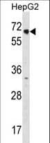 NR2C1 Antibody (aa516-545)