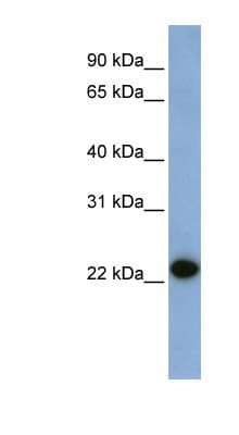 CAV1 / Caveolin 1 Antibody (N-Terminus)