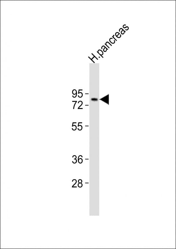 SPHK2 Antibody (aa52-84)