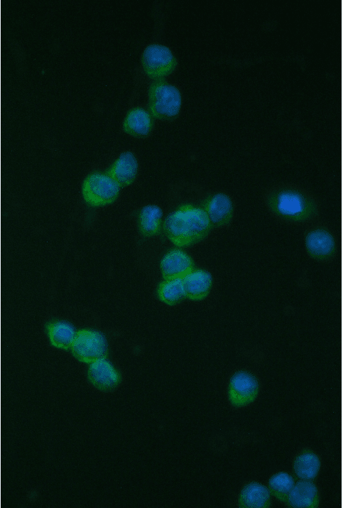 Polyclonal Rabbit anti-Human ITGB2 / CD18 Antibody (aa404-769, IHC, WB)