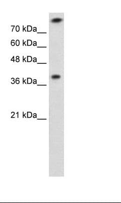 Rhodanese / TST Antibody (aa101-150)