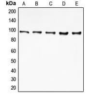 DAP-5 / EIF4G2 Antibody (N-Terminus)