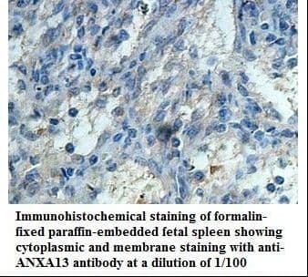 ANXA13 / Annexin XIII Antibody (aa100-316)