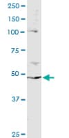 IHC-plus™ PPP2R2B Antibody (aa22-128, clone 1F3)