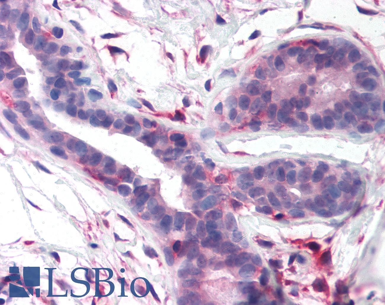 IHC-plus™ Polyclonal Rabbit anti-Human FAK / Focal Adhesion Kinase Antibody (Kinase Domain, IHC)