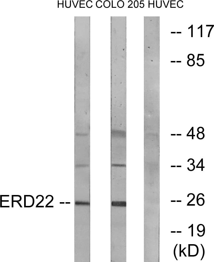 IHC-plus™ Polyclonal Rabbit anti-Human KDELR2 Antibody (aa81-130, IHC, IF, WB)