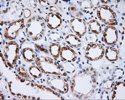 BTK Antibody (clone OTI3E9)
