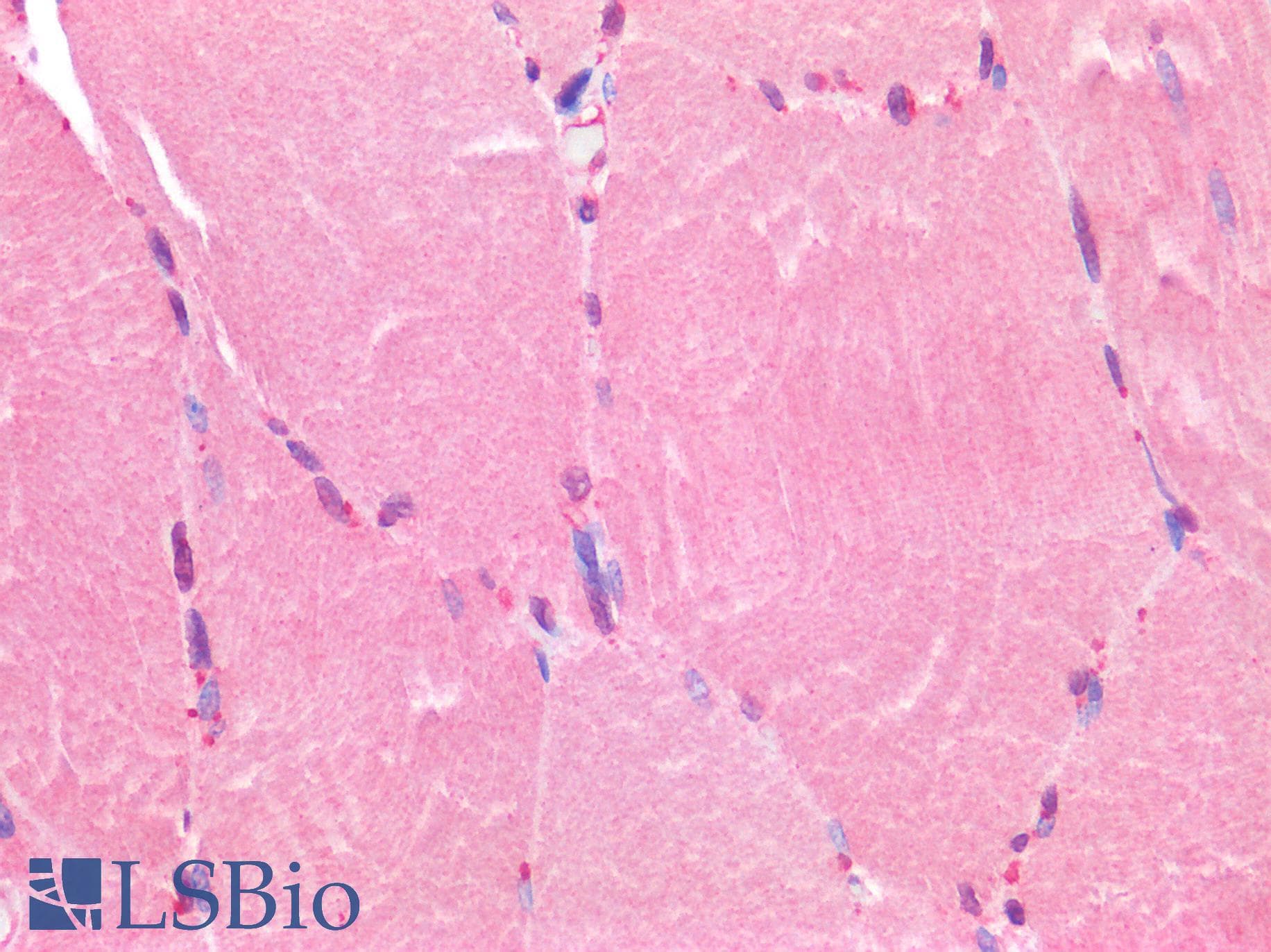 IHC-plus™ FOXC1 Antibody