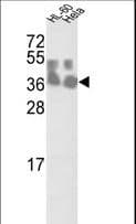 CLNS1A Antibody (aa148-176)