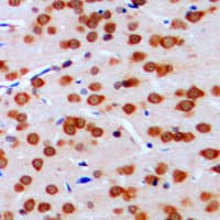 MLX / TCFL4 Antibody (Internal)