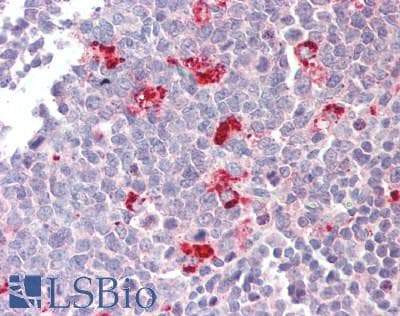 IHC-plus™ DEFA1 / Defensin Alpha 1 Antibody