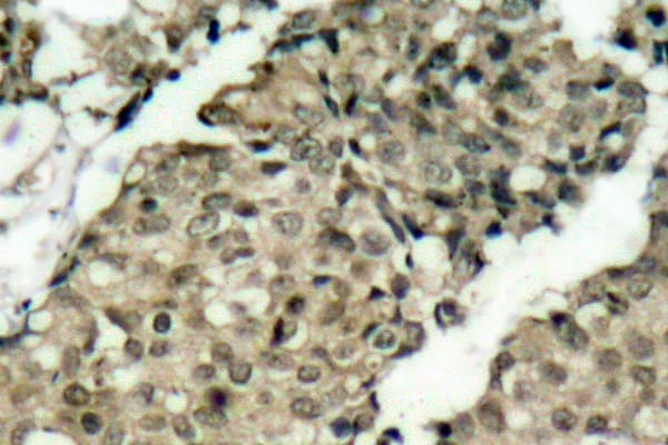 G3BP1 / G3BP Antibody (phospho-Ser232)