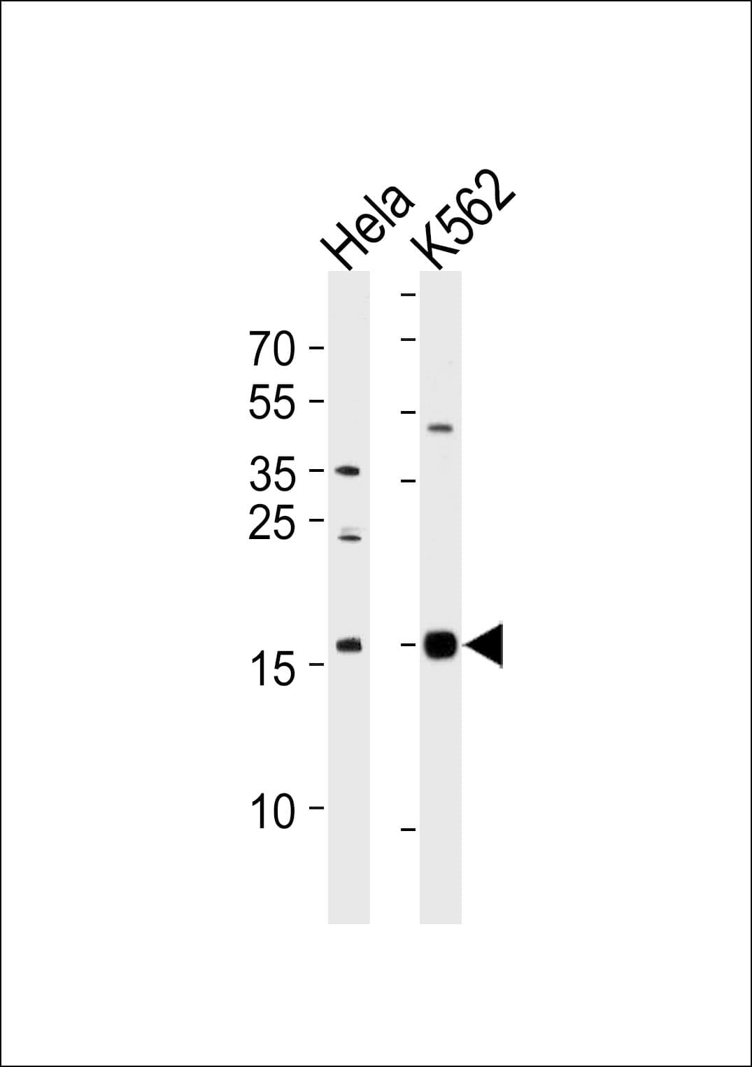 PPIL1 Antibody (aa63-91)