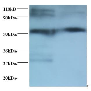Rabbit Anti-Human IgG Fc Secondary Antibody