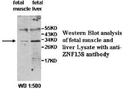 ZNF138 Antibody (aa1-172)