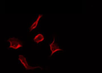 RNF144A / RNF144 Antibody