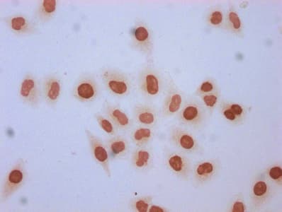 HIST1H1C Antibody