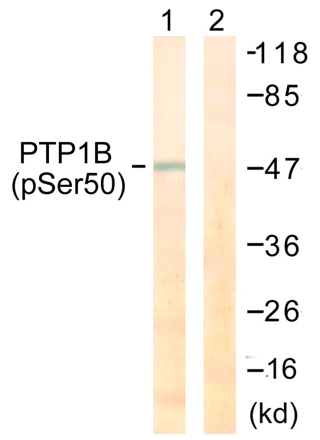 Polyclonal Rabbit anti-Human PTP1B Antibody (phospho-Ser50, IHC, WB)