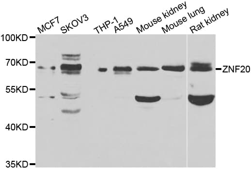 Polyclonal Rabbit anti-Human ZNF20 Antibody (IHC, WB)