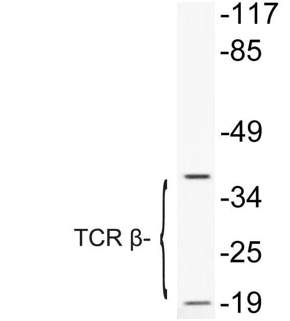 TCR Beta Antibody (Lys115)