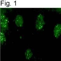 KCNIP3 / Dream / Calsenilin Antibody (Amino Acid: 30-45)