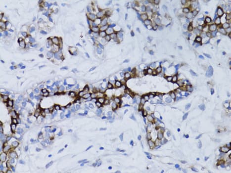 Polyclonal Rabbit anti-Human BRCA1 Antibody (IHC, IF, WB)