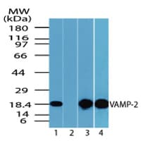 VAMP2 / VAMP-2 Antibody (aa1-50)