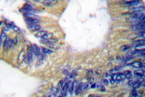 EIF4EBP1 / 4EBP1 Antibody (Asn63)