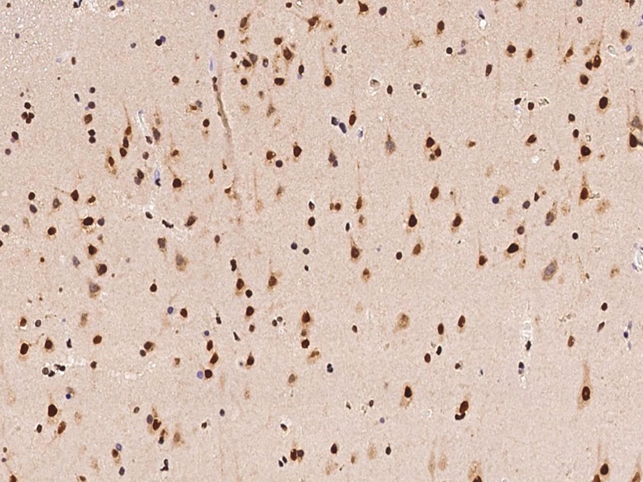 Polyclonal Rabbit anti-Human HNRPA1 / HnRNP A1 Antibody (IHC)