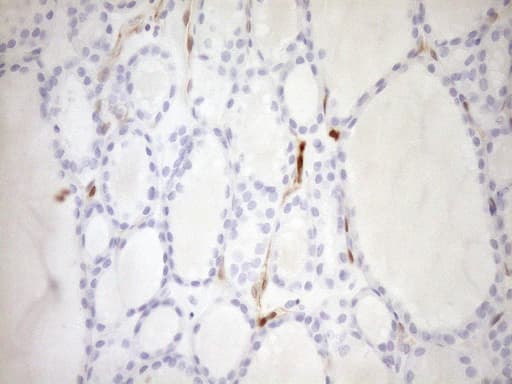 p16INK4a / CDKN2A Antibody (clone OTI1H3)