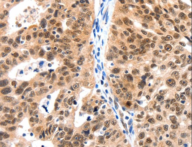 Polyclonal Rabbit anti-Human LRP5 Antibody (IHC)