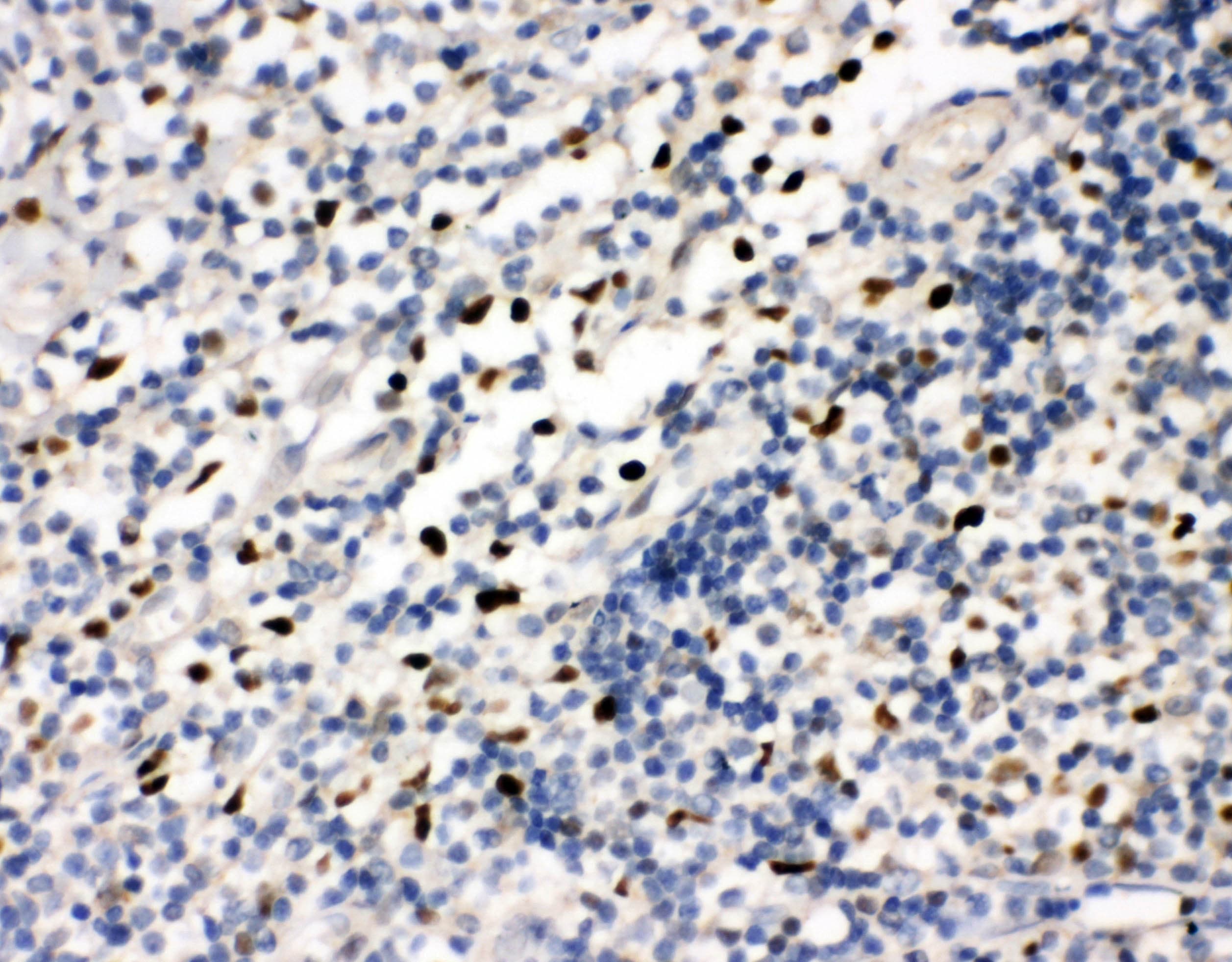 FLI1 Antibody (aa54-73)