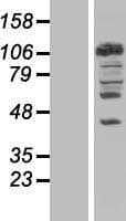 NEDD4 Protein (Over-Expression Lysate Myc-DDK (Flag))