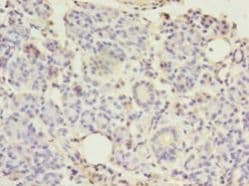 TMEM27 / Collectrin Antibody