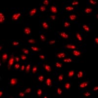 UMPS / OPRT Antibody